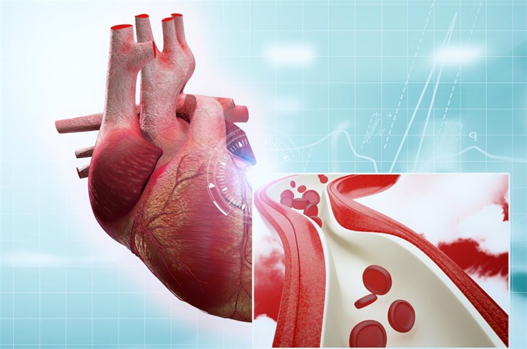 心血管疾病治疗或有新途径 AI技术发现冠心病罕见变异基因